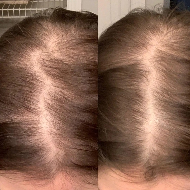 Nutrafol for hair growth