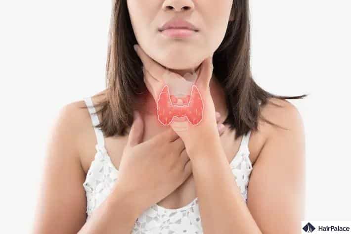 Thyroid disease may cause hair shedding