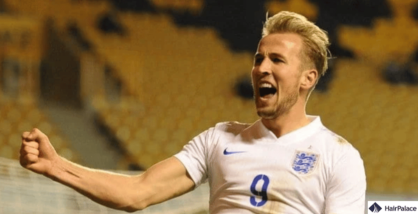 harry kane hair density crown