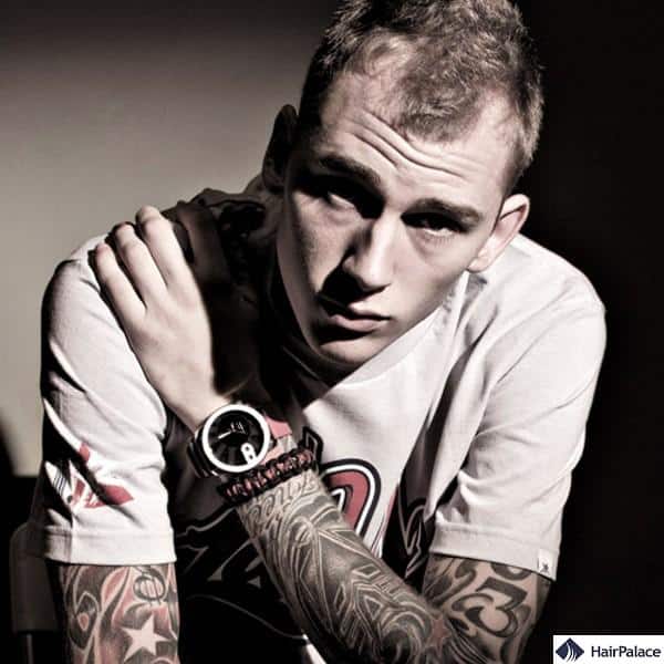 balding machine gun kelly