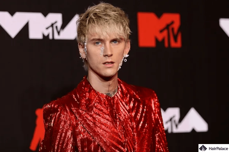 Machine Gun Kelly hair transplant result