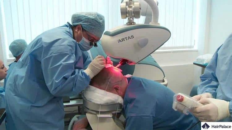 Robotic hair transplantation uses a robot for the extraction