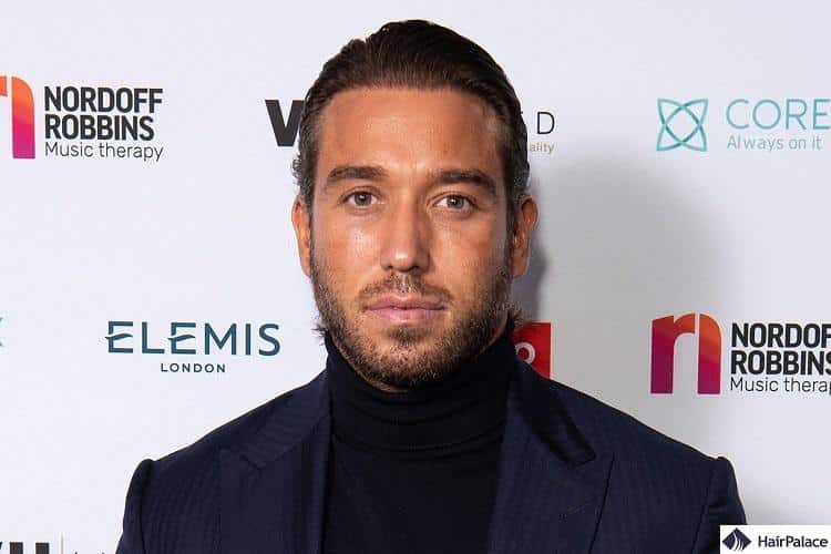 James Lock had a succesful hair transplant