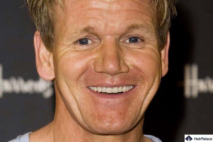 Gordon Ramsay whitened his teeth