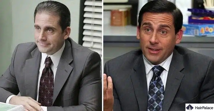 Steve Carell hair transplant before and after