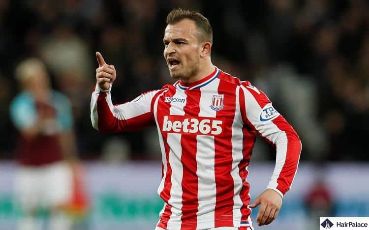 Xherdan Shaqiri's hair loss only got worse as time went on