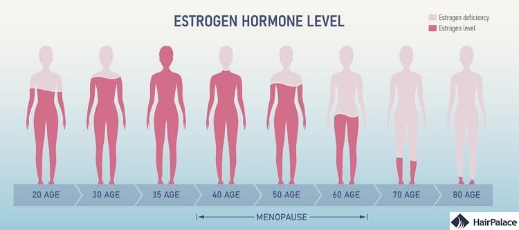 low estrogen levels may lead to hormonal hair loss
