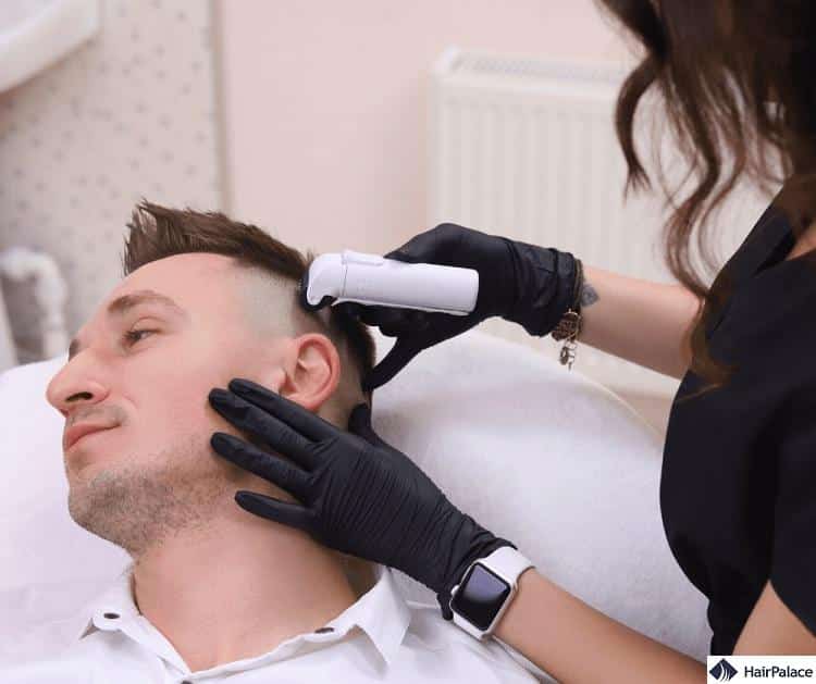 microneedling hair loss treatment process