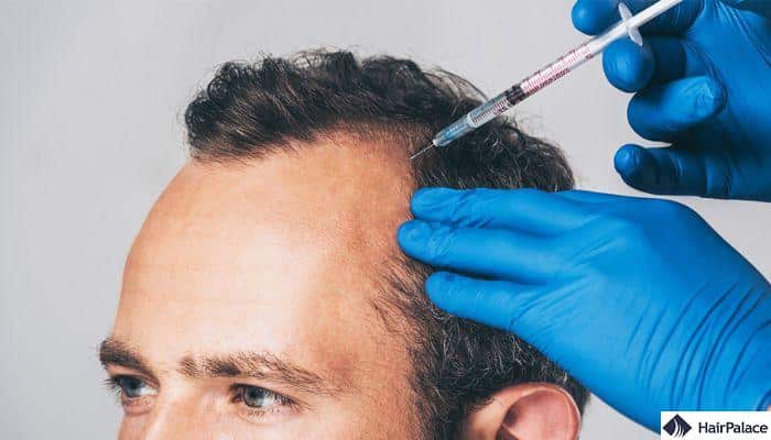 prp is a treatment for hair loss od diffuse thinning
