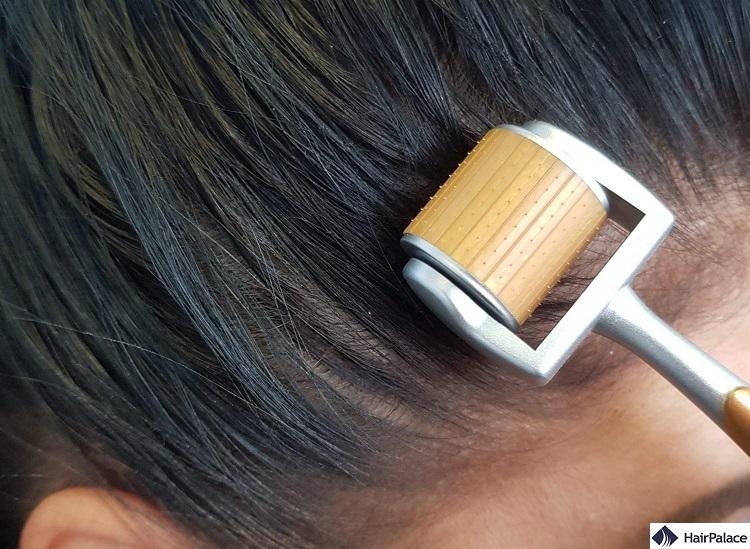 5 Best Derma Roller for Hair Growth in 2023 5 Best Derma Roller for Hair Growth in 2023
