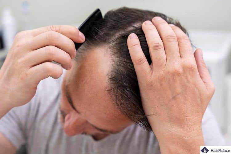 Hair loss treatment Finasteride shown strong results in studies in  increasing hair growth  Expresscouk