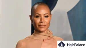 15 Famous Celebrities with Alopecia in 2024