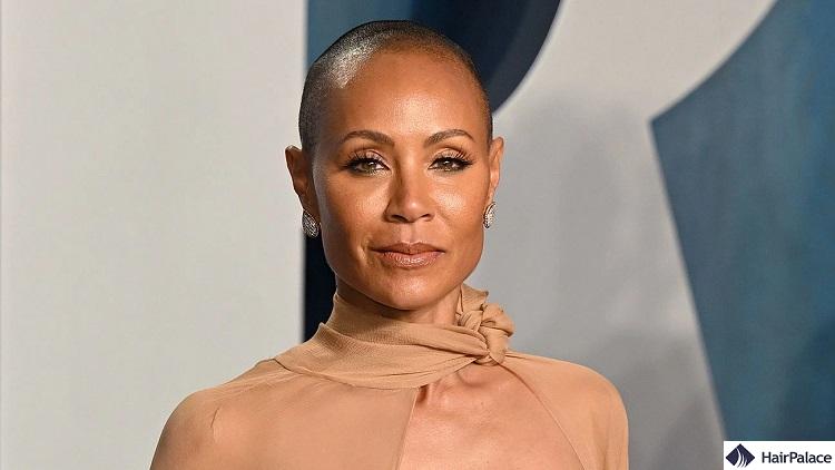 jada pinkett smith suffers from alopecia areata