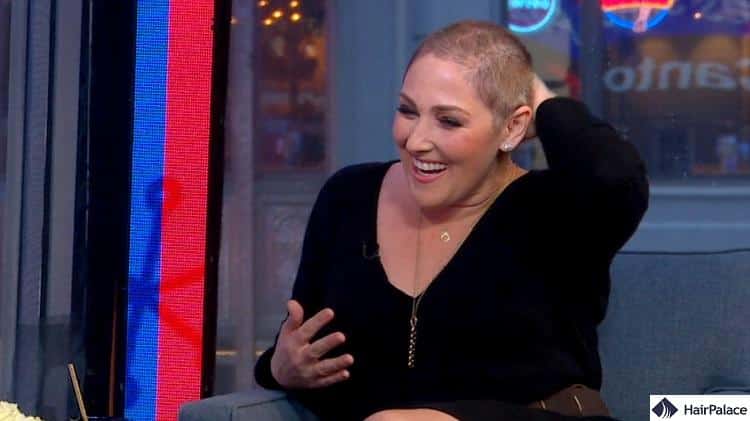 Ricki Lane suffers from alopecia