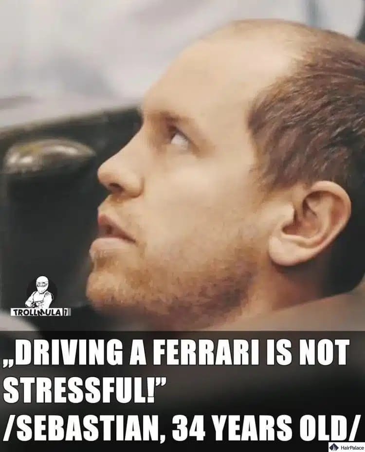 Sebastian Vettel with a large bald spot on his head