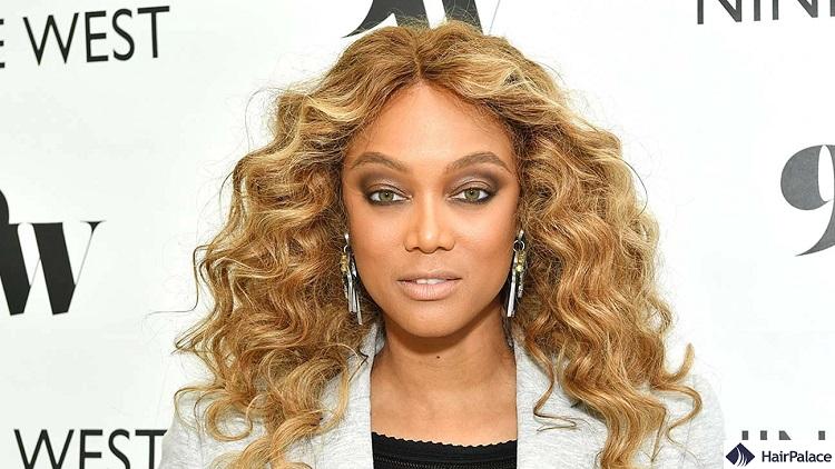 Tyra Banks also suffers from alopecia