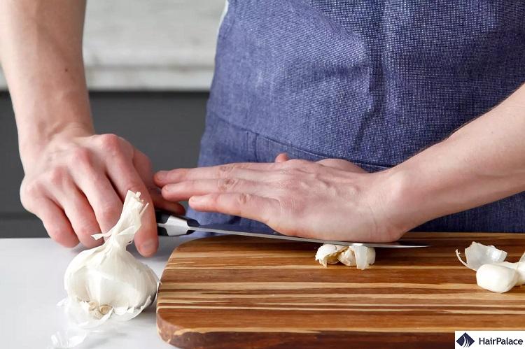 garlic can help prevent the formation of hairless patches