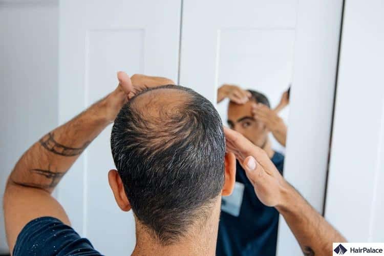 testosterone is not known to cause hair loss
