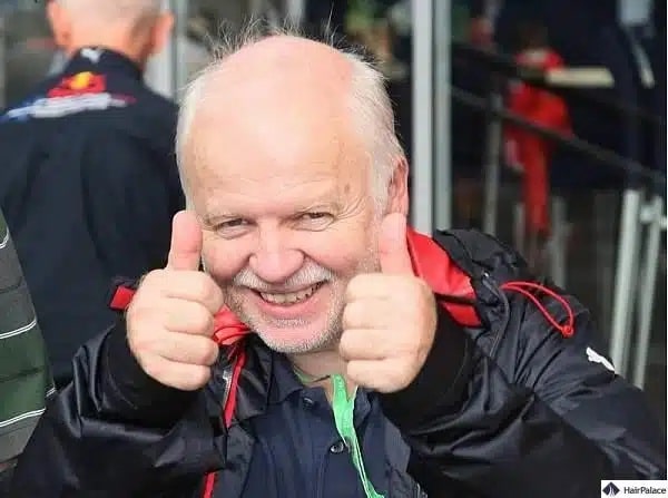 Sebastian Vettel and his dad both suffer from male pattern baldness