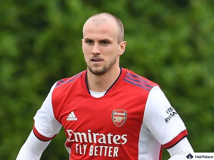Rob Holding bald
