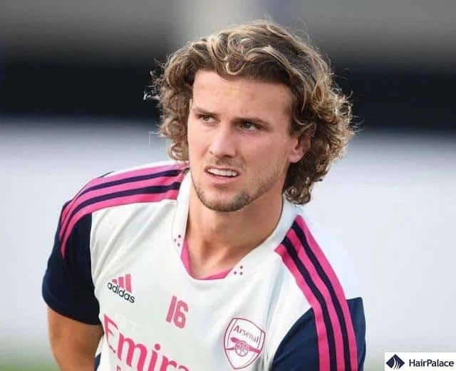 Rob Holding folllowing his hair transplant surgery