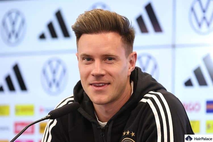 Ter Stegen Hair Transplant: What is the truth?