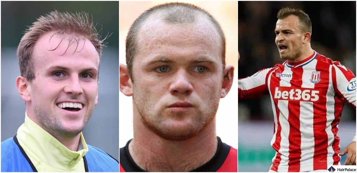 Hair expert reveals EXACTLY whats happened to Wayne Rooneys hair  Daily  Record