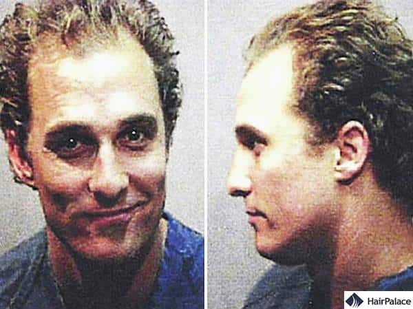 The Matthew Mcconaughey hair transplant rumours started shortly after this mugshot