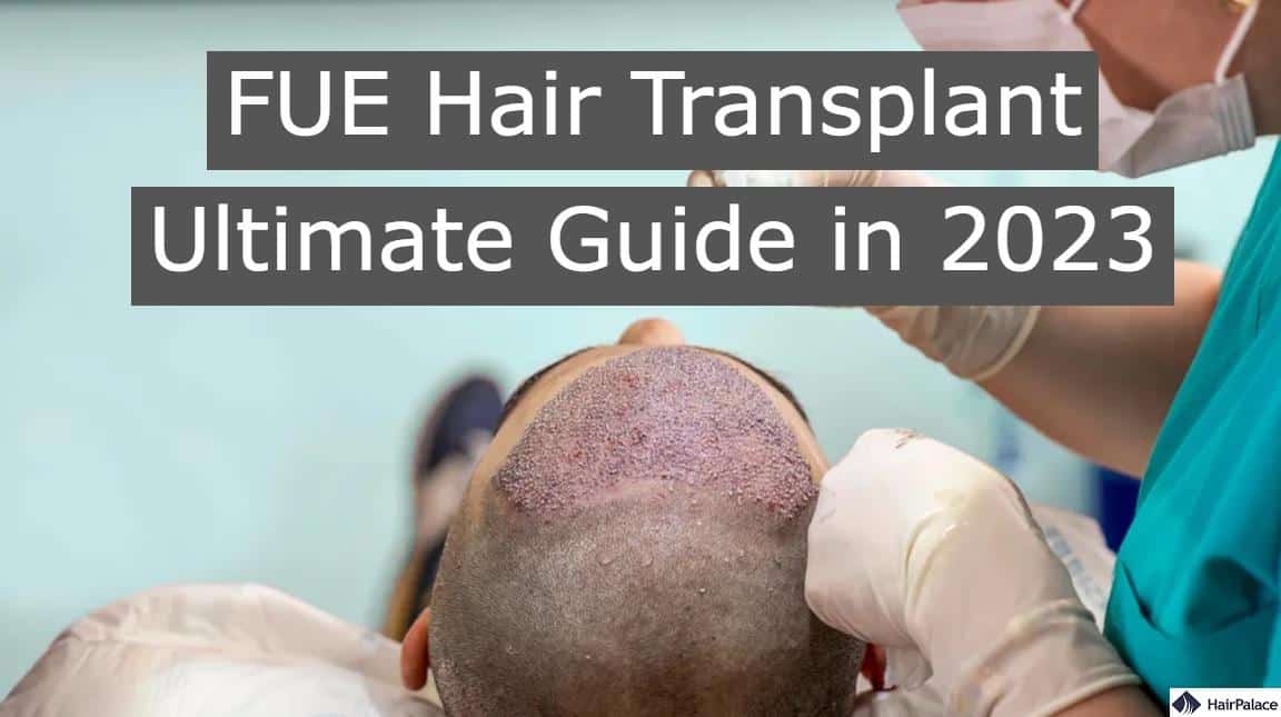 FUE hair transplant ultimate guide in 2023