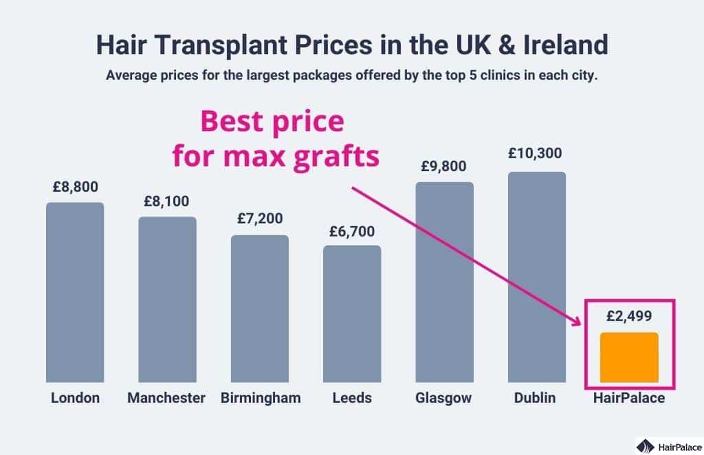 Average hair transplant price in the uk