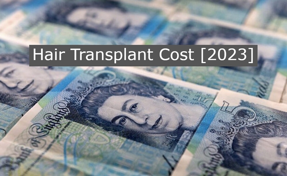 hair transplant cost 2023