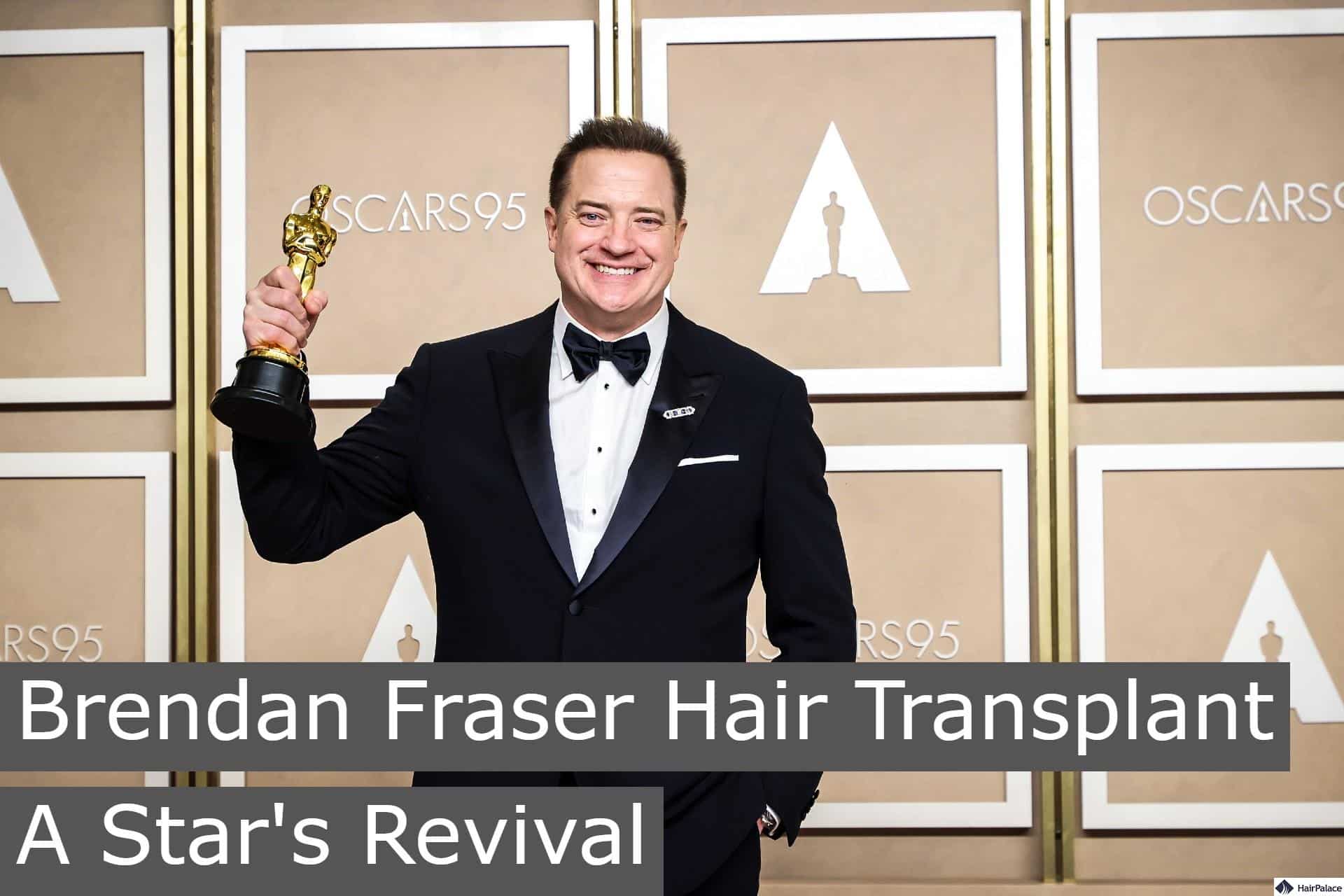 brendan fraser hair transplant a star's revival