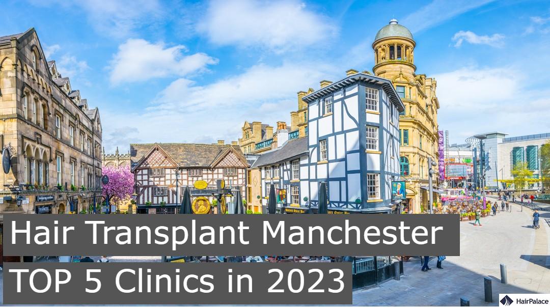 hair transplant manchester TOP 5 clinics in 2023