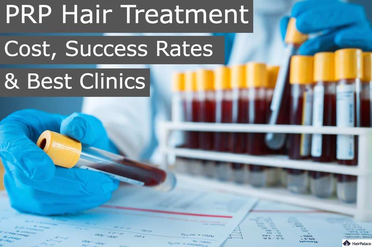 PRP hair treatment cost success rates and best clinics