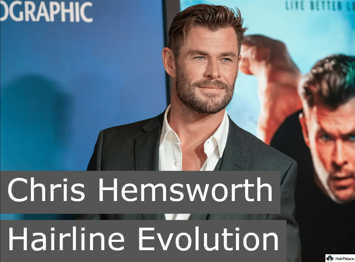 chris hemsworth hairline evolution