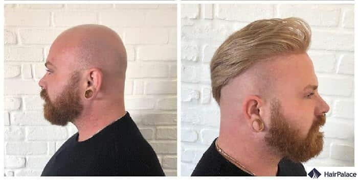 hair system before and after application