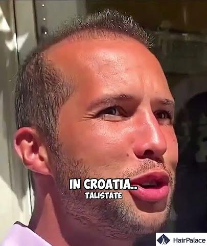 tristan tate bald in croatia
