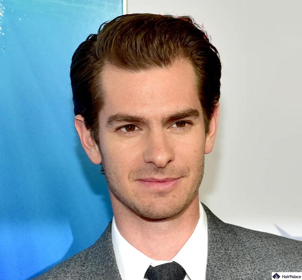 andrew garfield hair loss got more and more severe