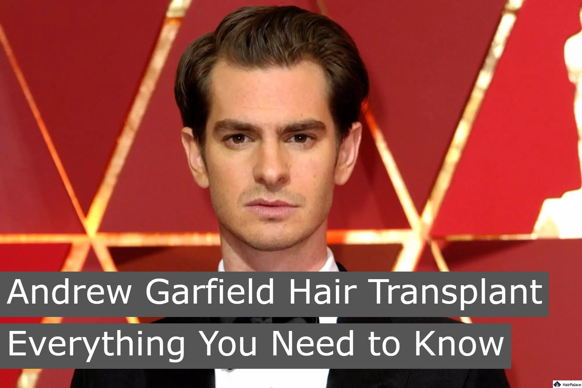 andrew garfield hair transplant everything you need to know