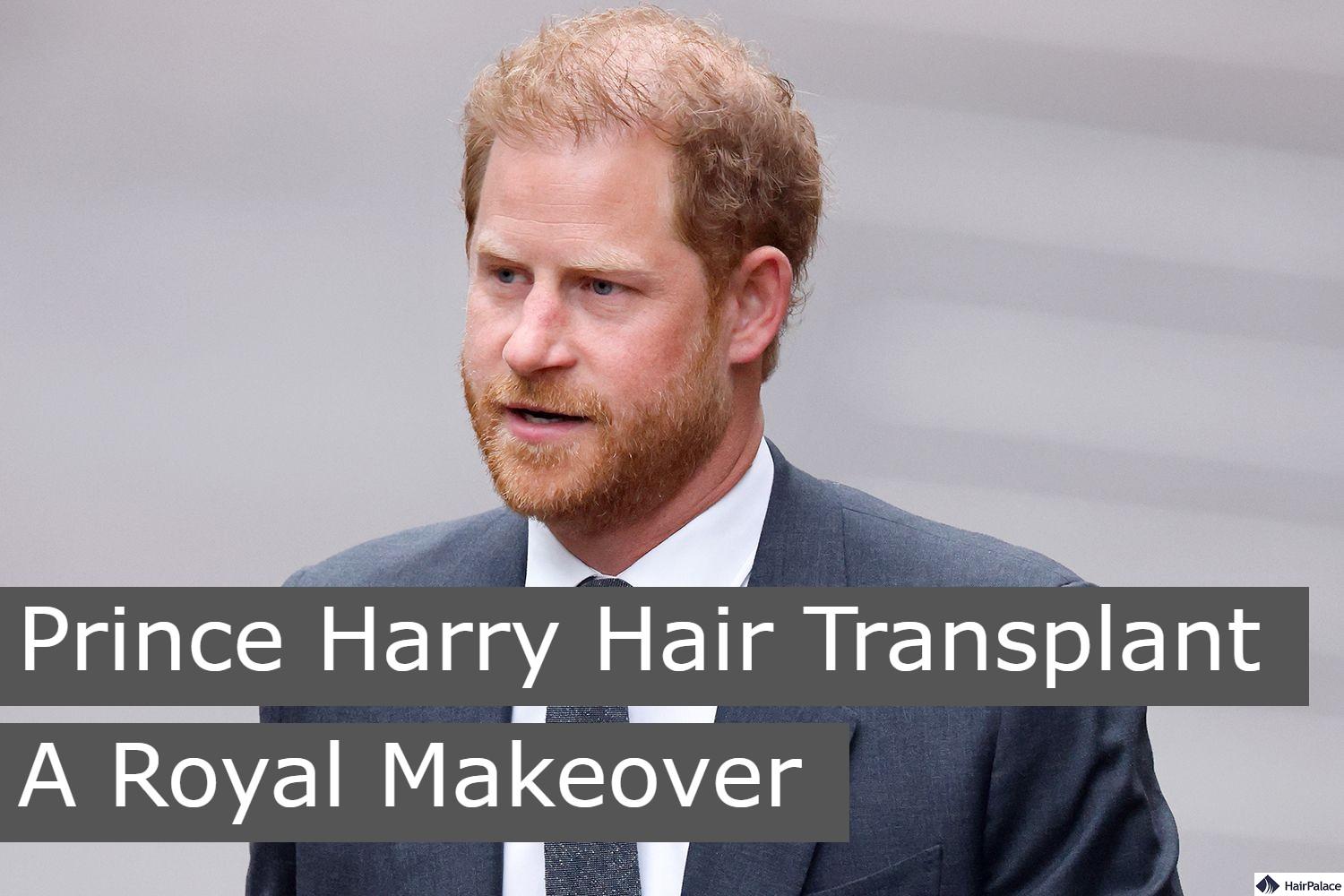 prince harry hair transplant a royal makeover