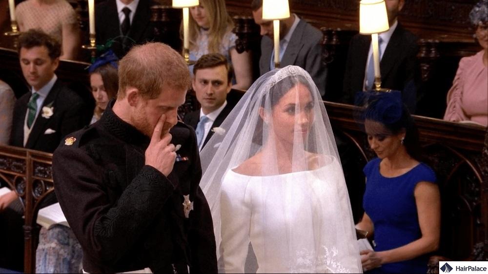 Prince harry hair thinning at his wedding