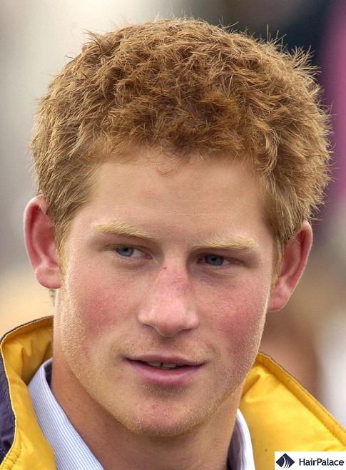 prince harry hair in his teens