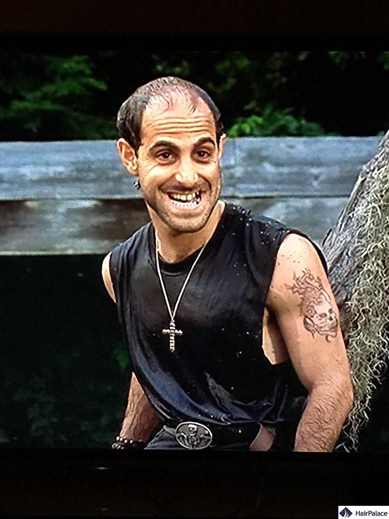 stanley tucci had extensive baldness since the start of his career