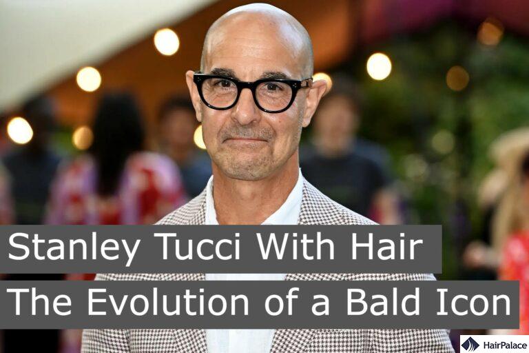 Stanley Tucci With Hair The Evolution Of A Bald Icon stanley-tucci-with-hair-the-evolution-of-a-bald-icon