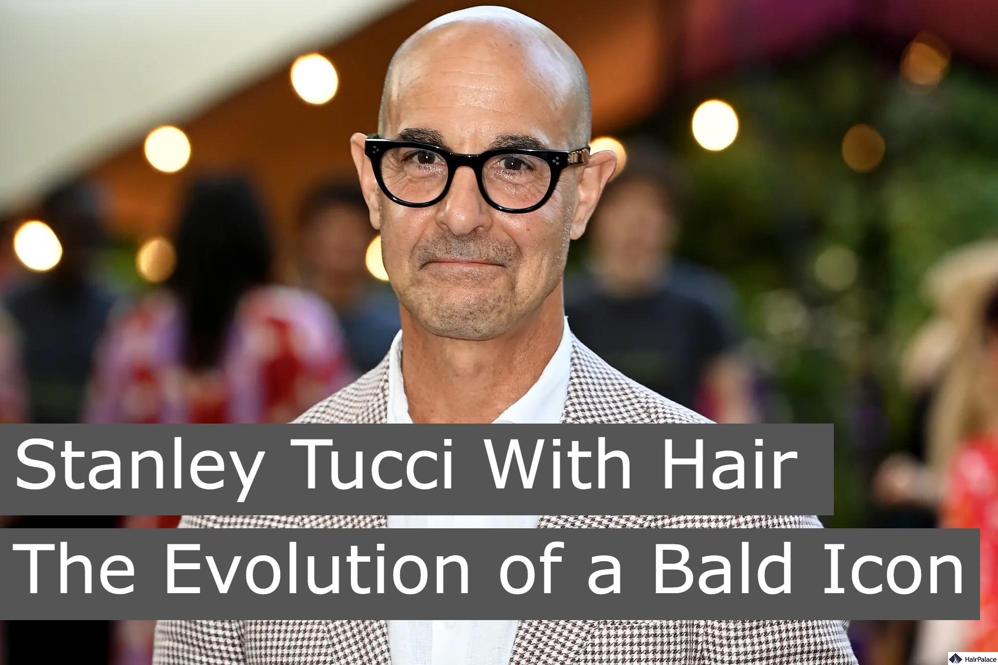 Stanley Tucci with hair the evolution of a bald icon