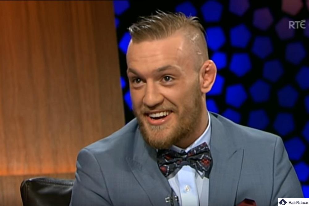 conor mcgregor hair loss