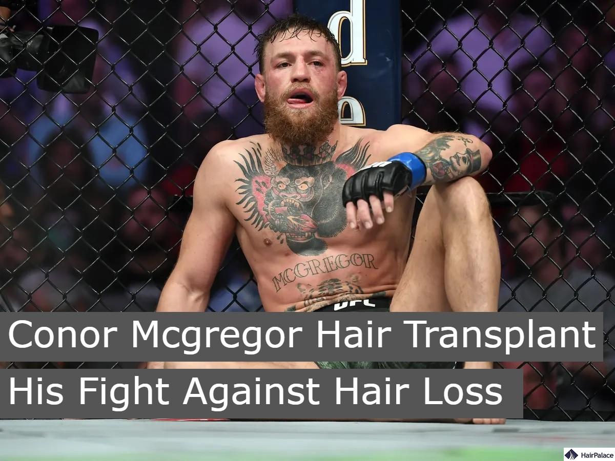 conor mcgregor hair transplant his fight against hair loss
