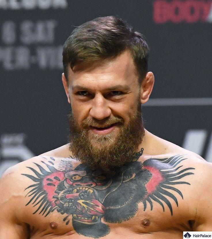 conor mcgregor receding hairline