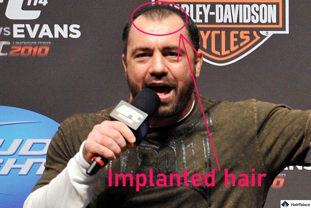 joe rogan widow's peak