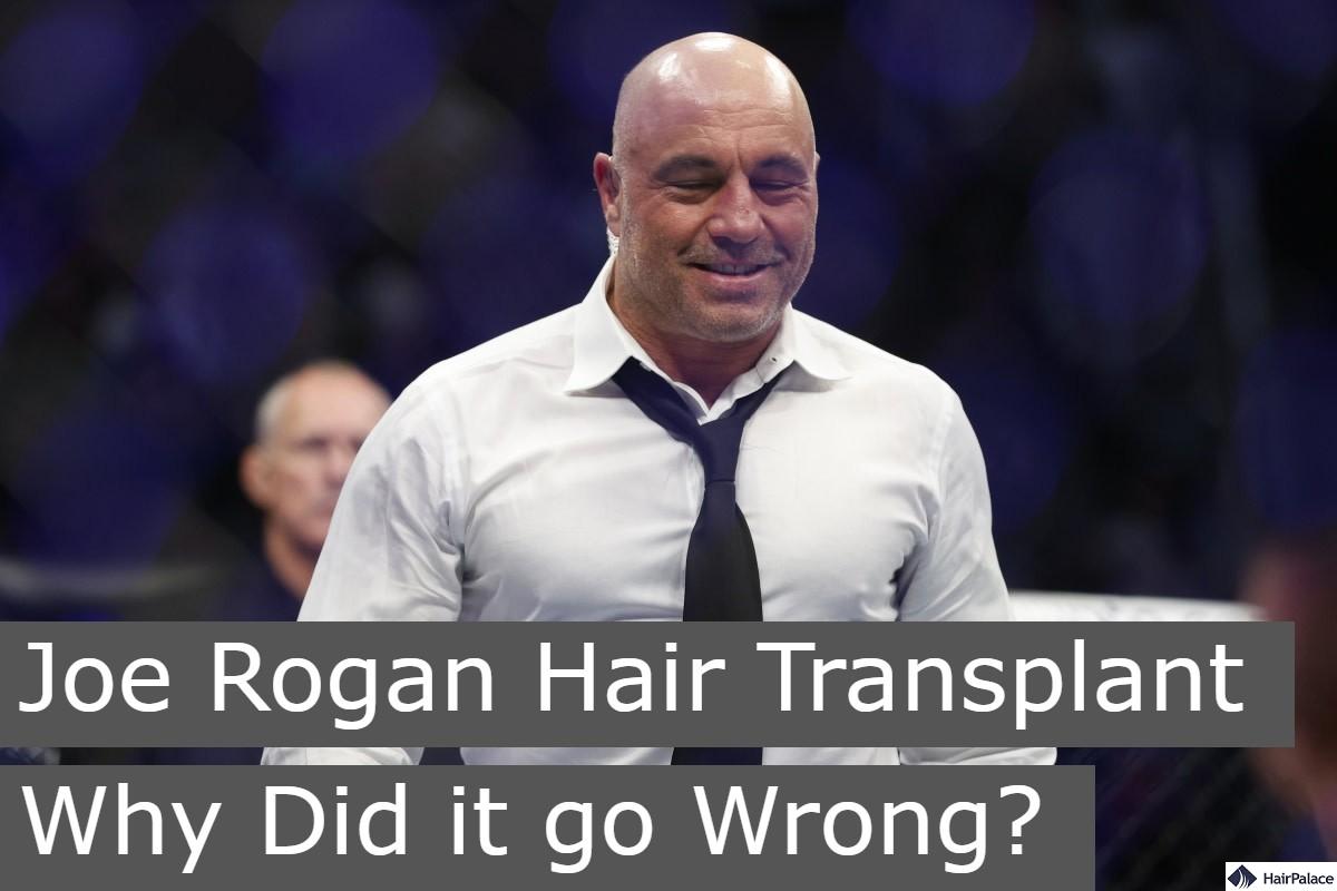joe rogan hair transplant why did it go wrong